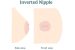 Inverted Nipple Menghambat Ibu Menyusui, Benarkah?