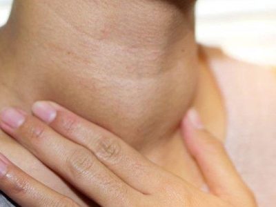 Kelenjar Getah Bening Penyakit Yang Membahayakan