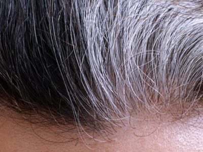 Perubahan Warna Rambut Menjadi Putih Di Sebut Sebagai Uban