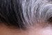 Perubahan Warna Rambut Menjadi Putih Di Sebut Sebagai Uban