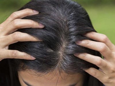 Rambut Beruban Mengurangi Rasa Percaya Diri