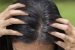 Rambut Beruban Mengurangi Rasa Percaya Diri
