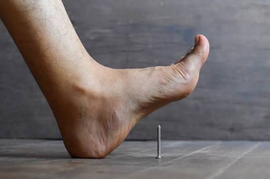 Infeksi Luka Tetanus Akibat Kotor Dan Tidak Bersih